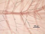 4 - Ramuli con cellule secretrici
